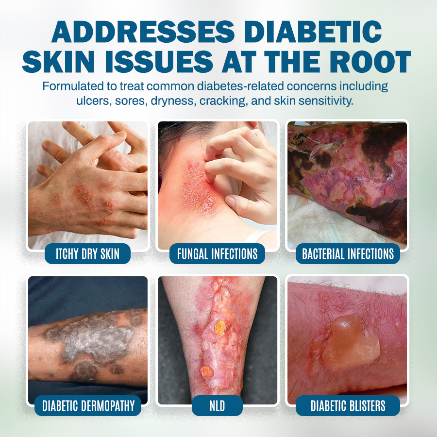 NEGUSY™ Skincare Designed for Diabetic Patients