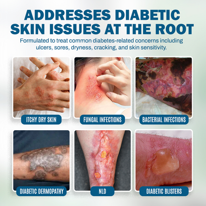 NEGUSY™ Skincare Designed for Diabetic Patients