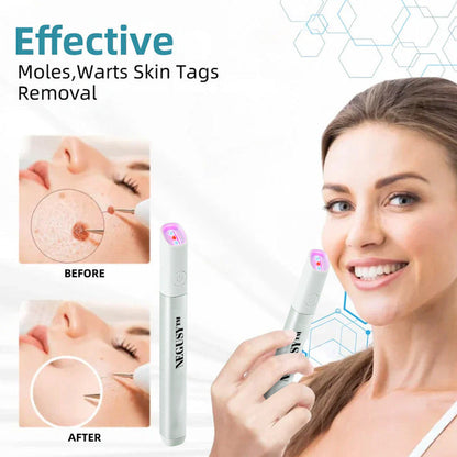 All-in-One CO₂ Laser Eraser Pen | Removes Moles, Warts, Skin Flaws & Pigmentation