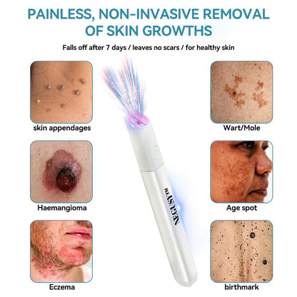 All-in-One CO₂ Laser Eraser Pen | Removes Moles, Warts, Skin Flaws & Pigmentation