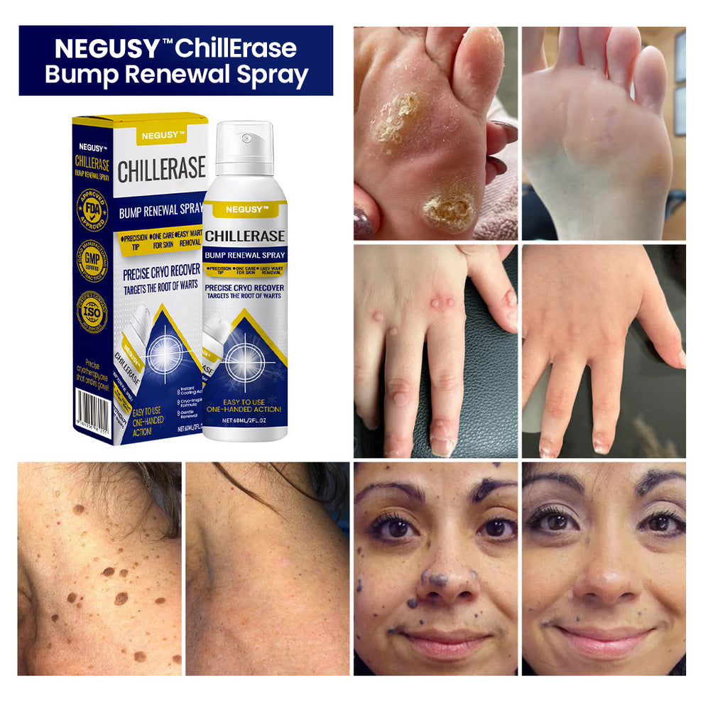 NEGUSY™ ChillErase Bump Renewal Spray