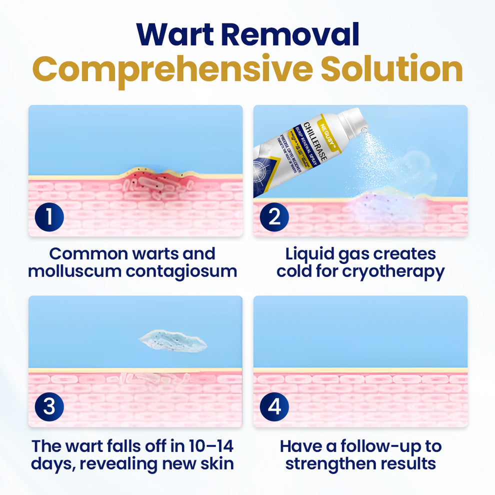 NEGUSY™ ChillErase Bump Renewal Spray