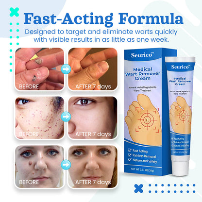 Seurico™ Medical Wart Removal Cream