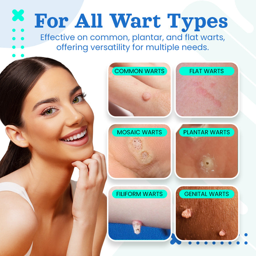 Seurico™ Medical Wart Removal Cream
