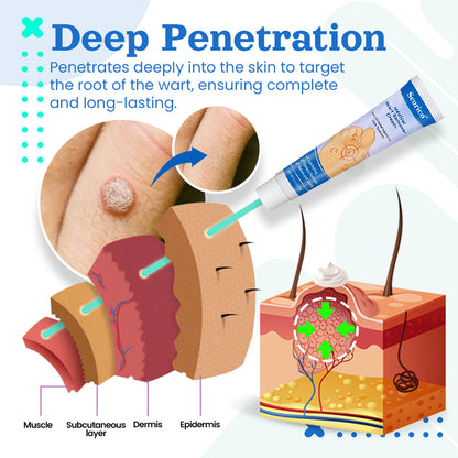 Seurico™ Medical Wart Removal Cream