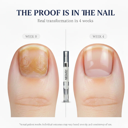 NEGUSY™ Antifungal Pen