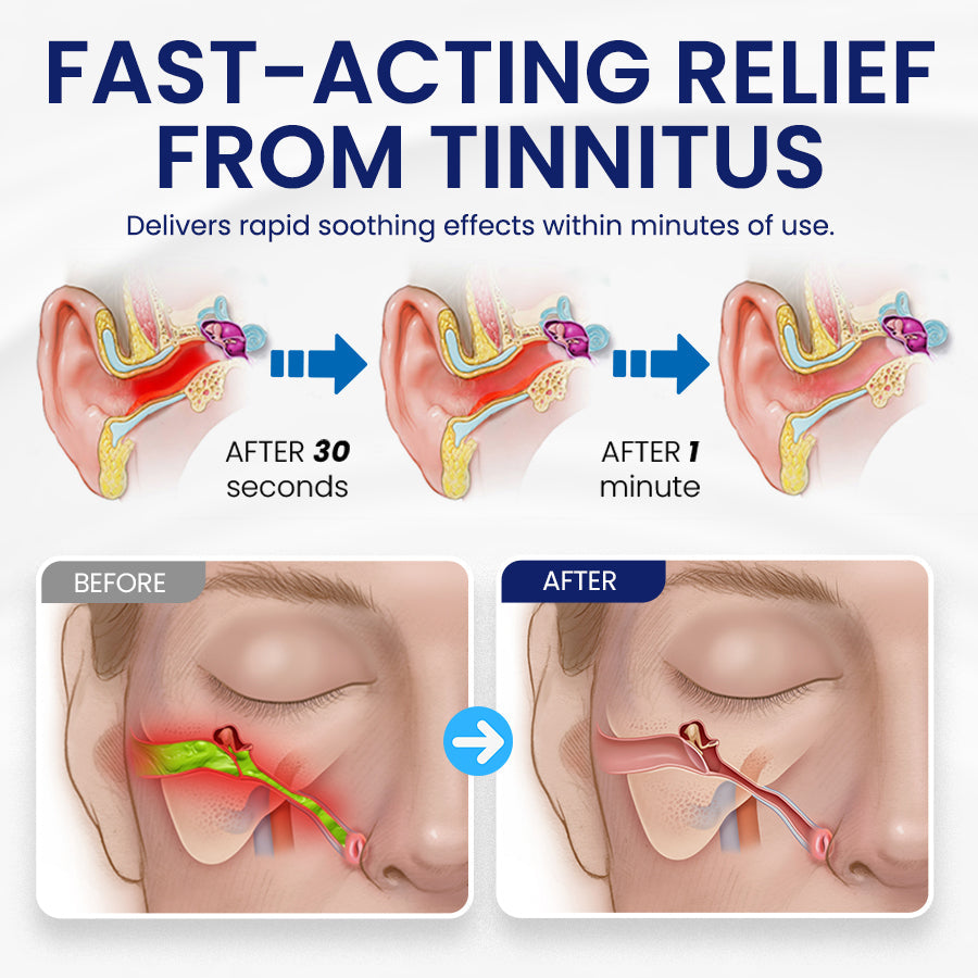 NEGUSY™ Tinnitus Relief Drops
