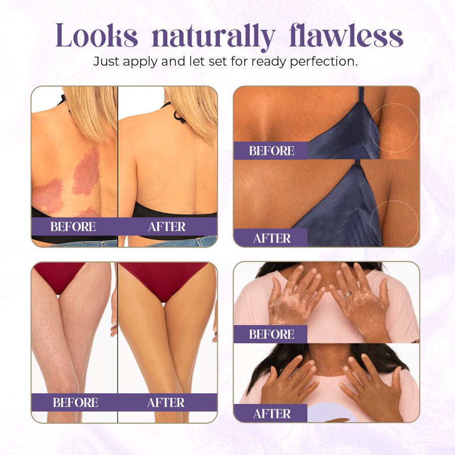 Zakdavi™ Body Coverage Perfector