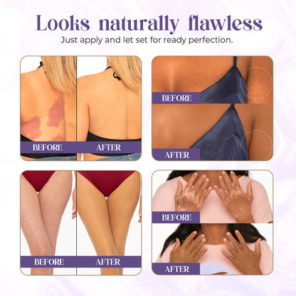 Zakdavi™ Body Coverage Perfector