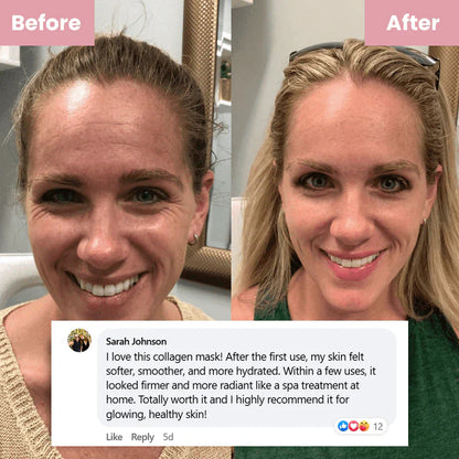 Buy 2 Collagen Night Masks, Get 1 Free! Wake Up to Youthful, Hydrated Skin!