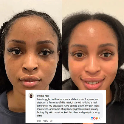 Buy 2 Collagen Night Masks, Get 1 Free! Wake Up to Youthful, Hydrated Skin!