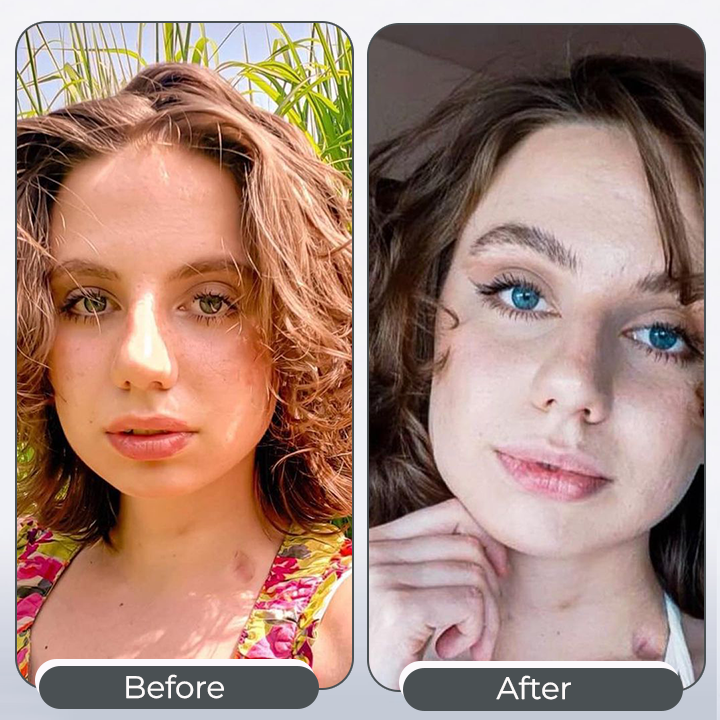 🌟Zakdavi™ IrisInk PRO Eye Drops